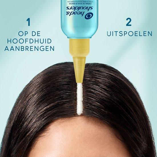 Head_Shoulders_Hoofdhuidbalsem_DERMAxPRO_Hydrateert_145_ml_3 - K Drogerie