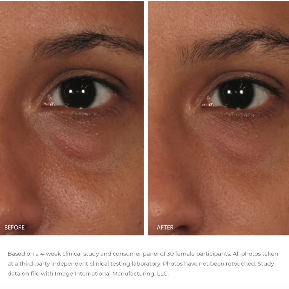 ORMEDIC_balancing_eye_lift_gel_PDP_R02 - K Drogerie