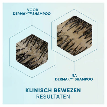 Head & Shoulders Anti-roos Shampoo DERMAxPRO Kalmeert 250 ml