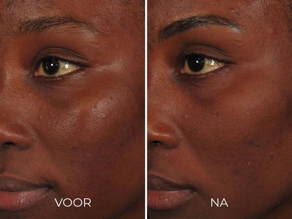 Image Skincare ILUMA - Intense Facial Illuminator 30 ml - K Drogerie